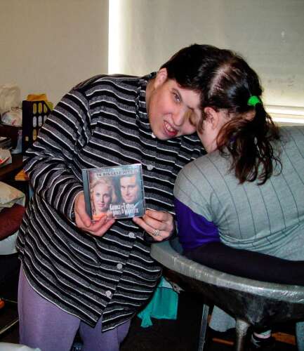 The Unexpected Ways Conjoined Twins Navigate The World - 8sd2v9m